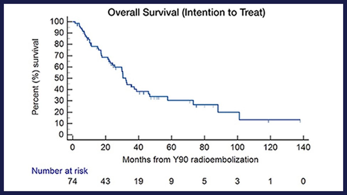 Radioembolization for Intermediate-Stage Hepatocellular Carcinoma Maintains Liver Function and Permits Systemic Therapy at Progression

jvir.org/article/S1051-…

Fig: Kaplan-Meier curve showing overall survival on intention-to-treat basis

<a href="/kush_r_desai/">Kush Desai</a> <a href="/riadsalemIR/">Riad Salem</a>