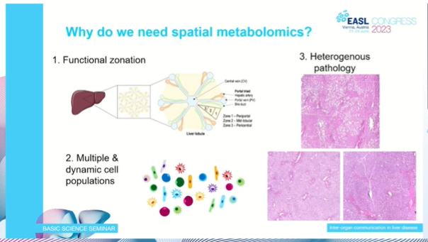 EASLedu's tweet image. Spatial metabolomics, why does it matter? 
@zoehall_ICL explains. 

#LiverTiwtter #EASLCongress #BasicScience