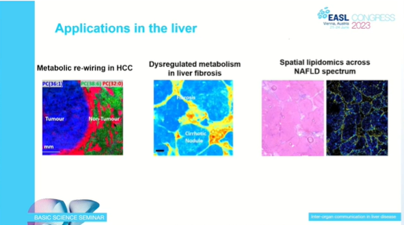 EASLedu's tweet image. Spatial metabolomics, why does it matter? 
@zoehall_ICL explains. 

#LiverTiwtter #EASLCongress #BasicScience