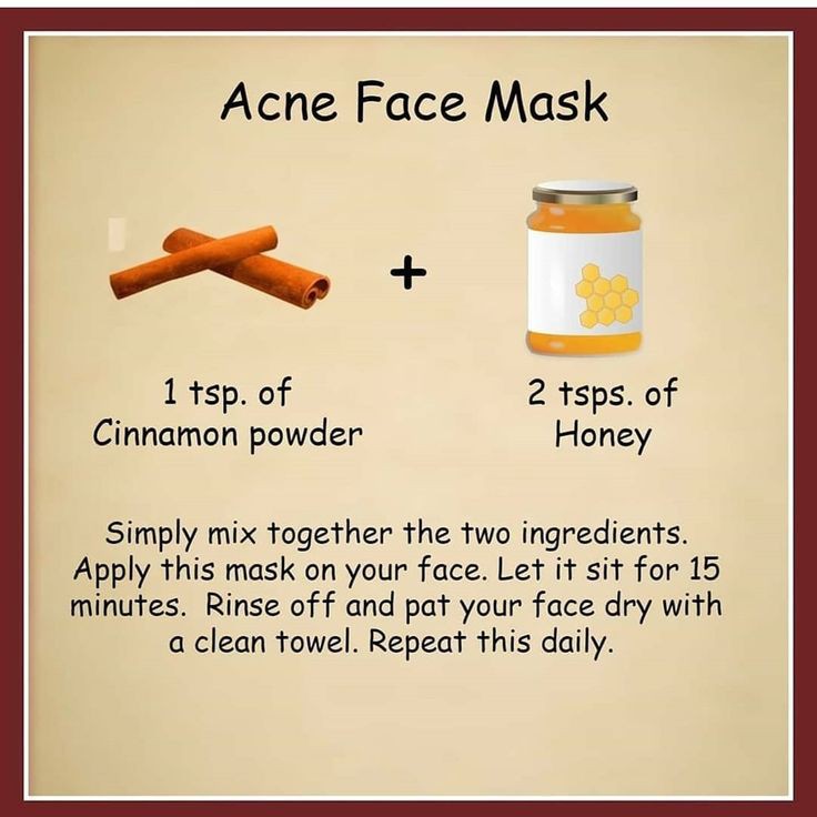 5. Acne Face Mask