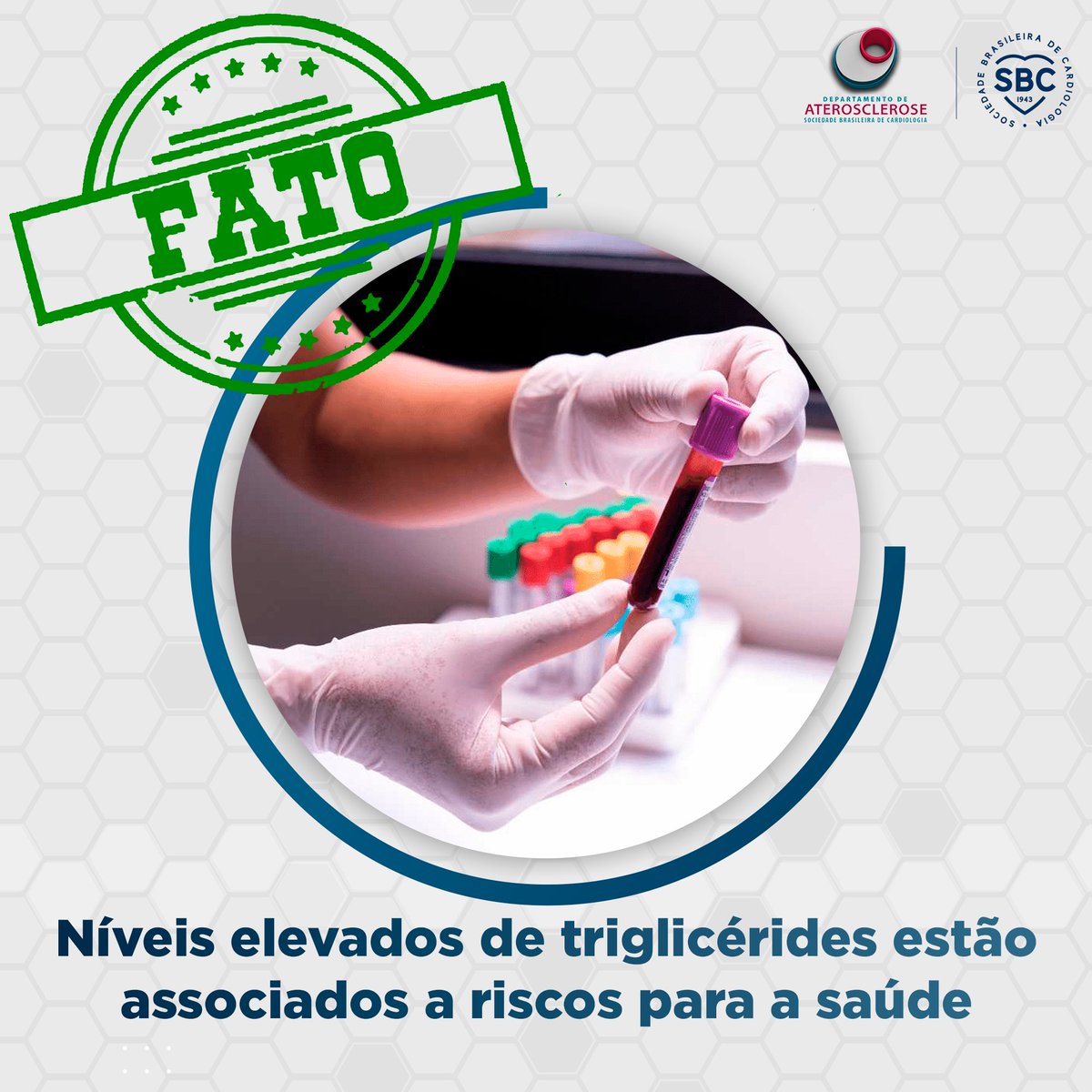 Fato. Altos níveis de triglicérides estão associados a riscos para a saúde. Níveis elevados de triglicérides no sangue (hipertrigliceridemia) podem aumentar o risco de doenças cardiovasculares, como ataques cardíacos e derrames. #sbcda #aterosclerose #dislipidemia