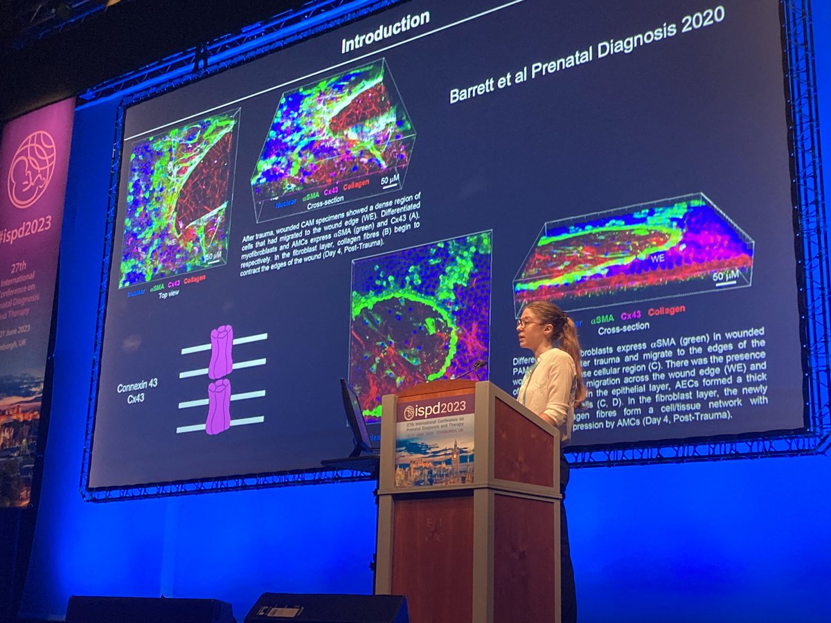 PrenatalTherapy's tweet photo. @miacrowther2 presenting our work @ISPDHQ #ISPD2023 showing that large defects in the amniotic membrane do not heal up. Cx43 may help -if the gap is small enough. Thanks to @CiaraOnly1 @PpromAwarenessU & @UCLHCharity @GOSHCharity for funding the work. @ttchowdhury @QMUL @UCL_IfWH https://t.co/oDjajvAayY