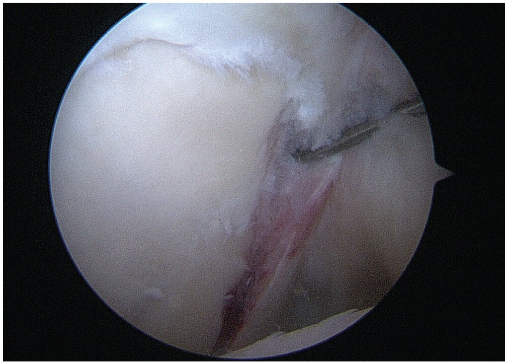 AOSSM Journals tweet media