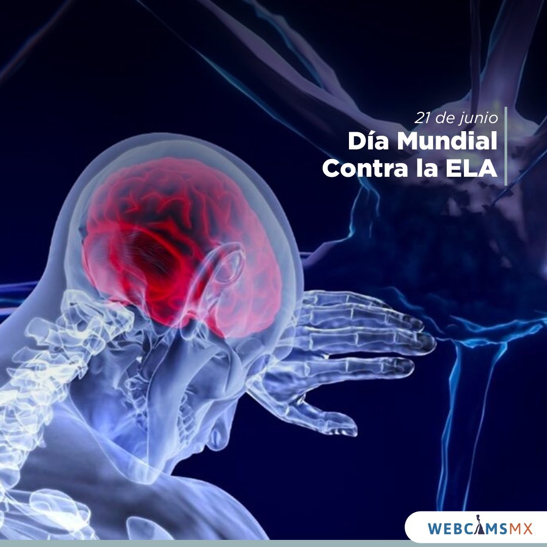 webcamsdemexico's tweet photo. 21 de junio, Día Mundial contra la Esclerosis Lateral Amiotrófica (ELA), una enfermedad neurodegenerativa. 🧠

El objetivo de este día, es mejorar los servicios de salud 🧬 y la correcta detección; además de fomentar el acceso a la información y crear conciencia en la población. https://t.co/mZEiQsY2uR