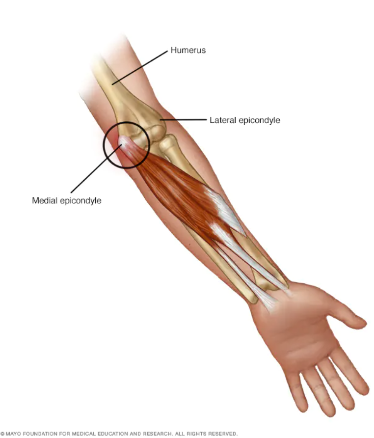 ASESmembers's tweet photo. 3 Facts about Golfers’ Elbow:
https://t.co/N2PeI9YvTj occurs most commonly in your 40’s
https://t.co/NL9SbYt1IR don’t have to play golf to get it
3.Most of the time it gets better with exercise
#ASESMembers #GolfersElbow #OrthoTwitter https://t.co/ctsDb1i44a