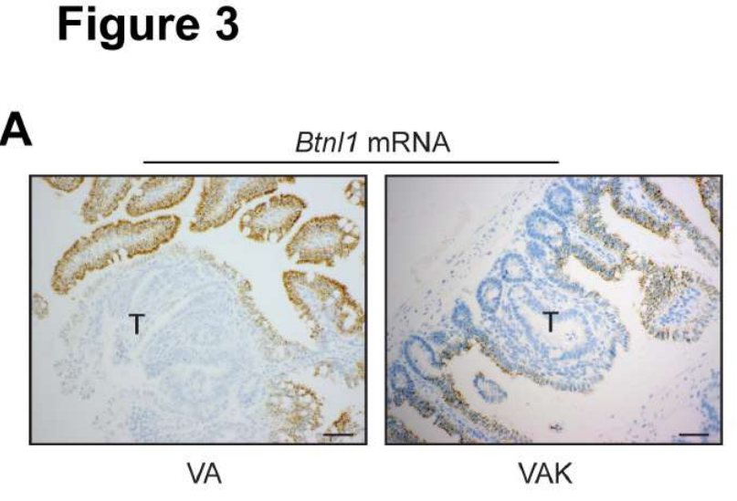 Read the paper by Seth B. Coffelt @CoffeltLab et al.
β-catenin drives butyrophilin-like molecule loss and γδ #Tcell exclusion in #coloncancer.
aacrjournals.org/cancerimmunolr…
@CRUK_BI @UofGlasgow