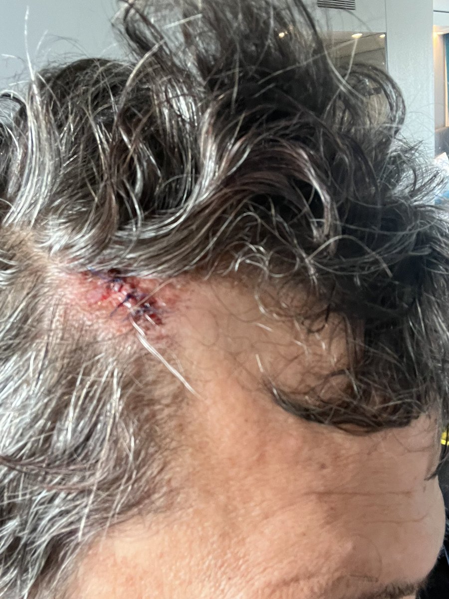 also ich muss jetzt mal ein dickes lob an die rettungskräfte und das pflegepersonal und die ärztinnen in der <a href="/ChariteBerlin/">Charité - Universitätsmedizin Berlin</a> aussprechen. ich weiß nicht, ob man schneller; netter, witziger und kümmernder agieren kann. und das bei so ner kleinen beule wie meiner. danke! tolles team