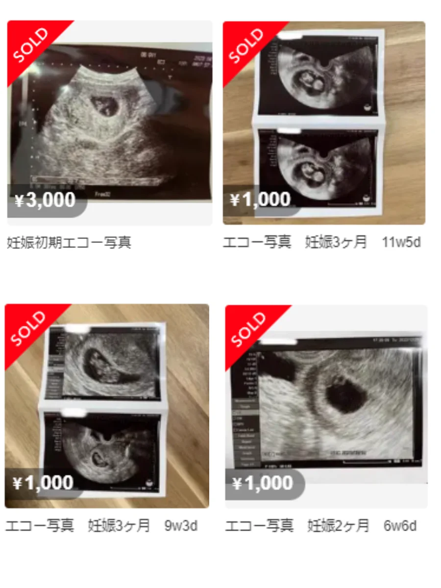 【悲報】もう悪さは出来ない。メルカリで売られていたのは、なんと『エコー写真』だった