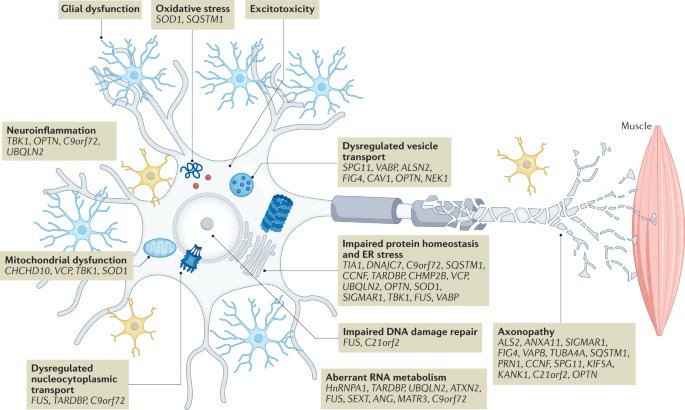 Los avances en genómica han descubierto una variedad de genes relacionados a la esclerosis lateral amiotrófica (ELA)

Las variantes genéticas muestran mecanismos alterados en diferentes compartimentos celulares de las motoneuronas y células gliales #LuzporlaELA #DiaMundialdelaELA