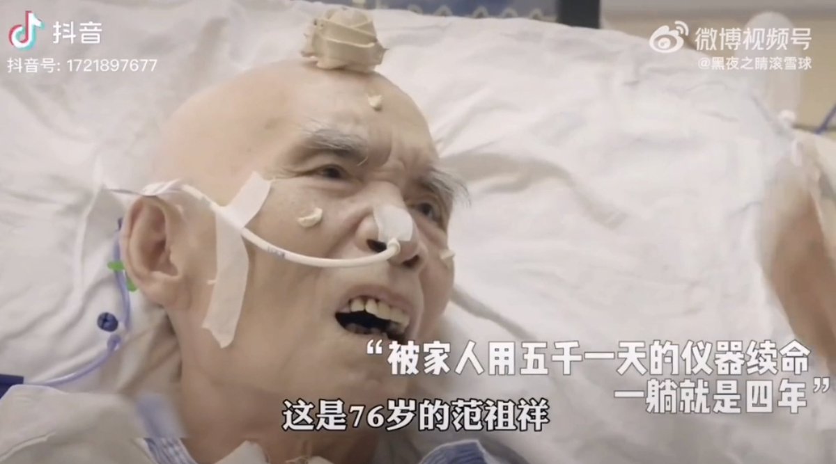 上海市高级法院原党委书记范祖祥, 死前在上海瑞金医院最高级的ICU抢救, 一抢救, 就抢救了4年! 不是4天, 不是4个礼拜, 不是4个月, 是4年! 各种先进器材轮番上阵 ... 按照平均每天5万来算, 光是抢救他一个人就花了近亿人民币，最后仍在极度痛苦中日夜煎熬了4年! 蹬腿去世。全国还有多少这样中共老僵尸？