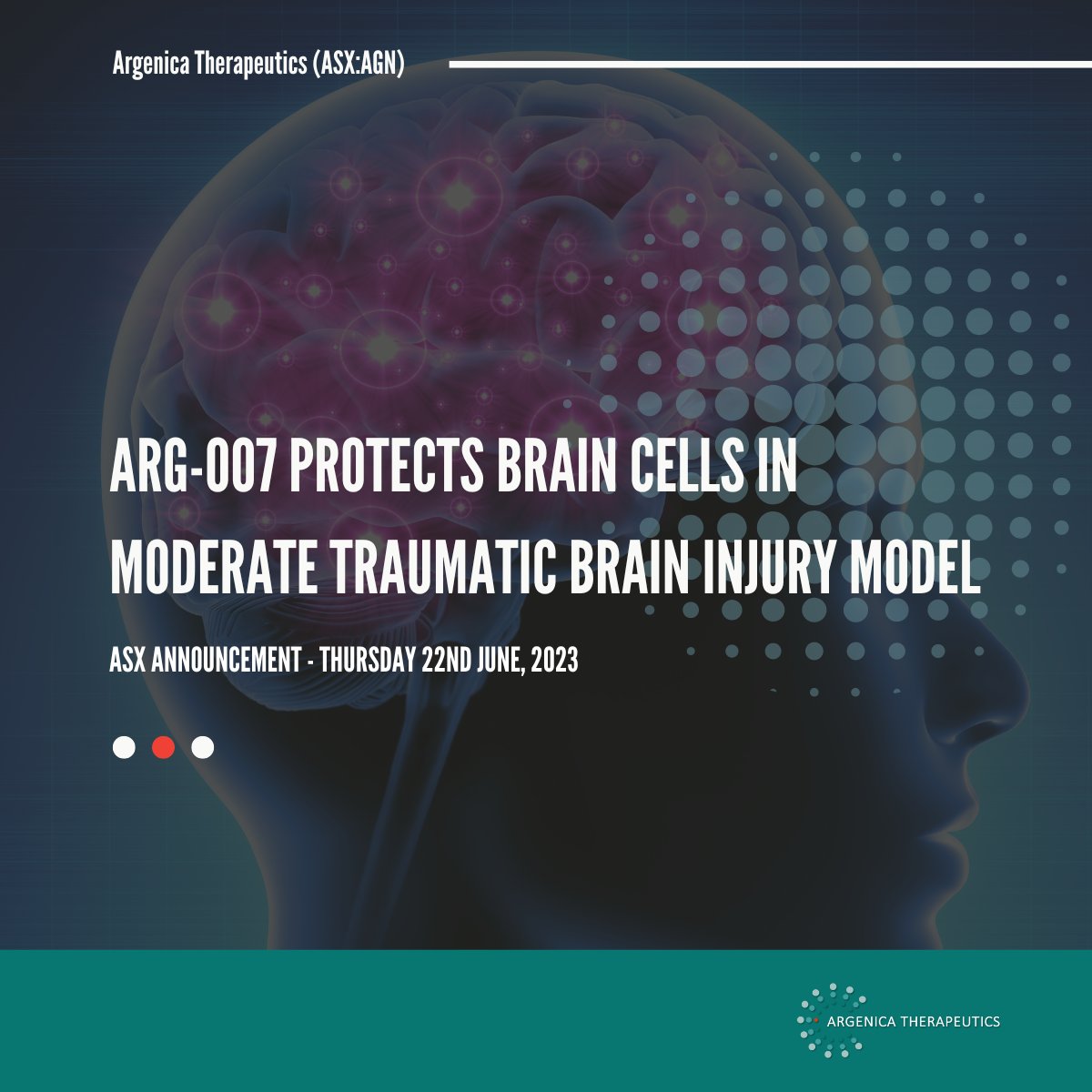 ArgenicaT's tweet photo. #AGN is pleased to provide an update from a preclinical study assessing the efficacy of #ARG007 in a rat model of moderate traumatic brain injury.

This study, conducted by Prof Lindy Fitzgerald at @CurtinUni and the @PerronInstitute  

Read more: https://t.co/W4cIG9dsVh https://t.co/jCYjy7rmcG
