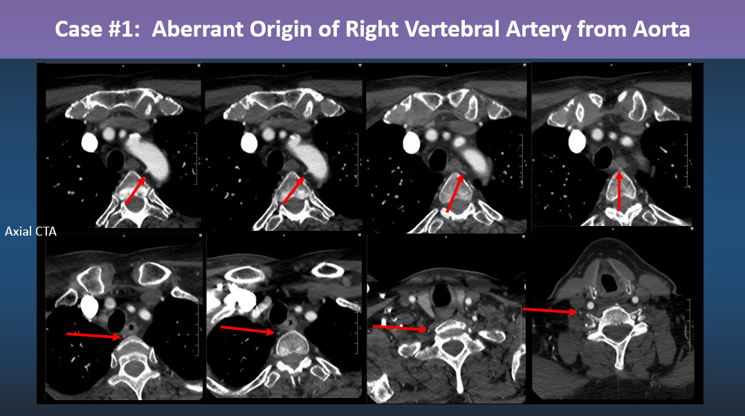 Philip R. Chapman, MD tweet media