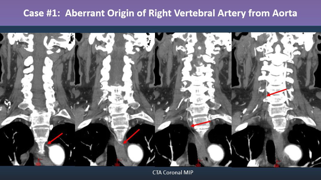 Philip R. Chapman, MD tweet media