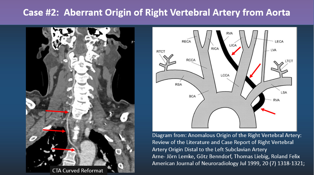 Philip R. Chapman, MD tweet media