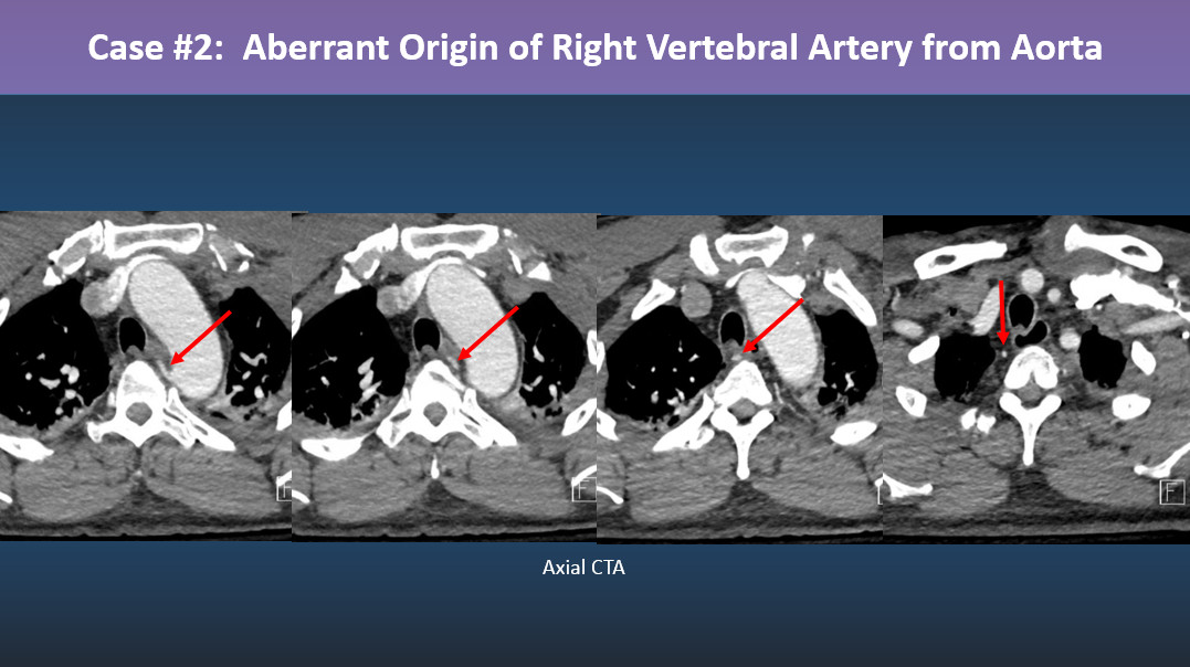 Philip R. Chapman, MD tweet media
