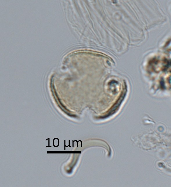 Hi #pollen people. Any tips on this little friend? I don't have an E-view photo but it is: C3P0; E x P-axis ~20µm x 15µm; microreticulate; colpi open @ equator with an endo-wall. From Philippines highland forests. @thatpollenguy @FossilPollen @PalyJen @J_StevensonANU