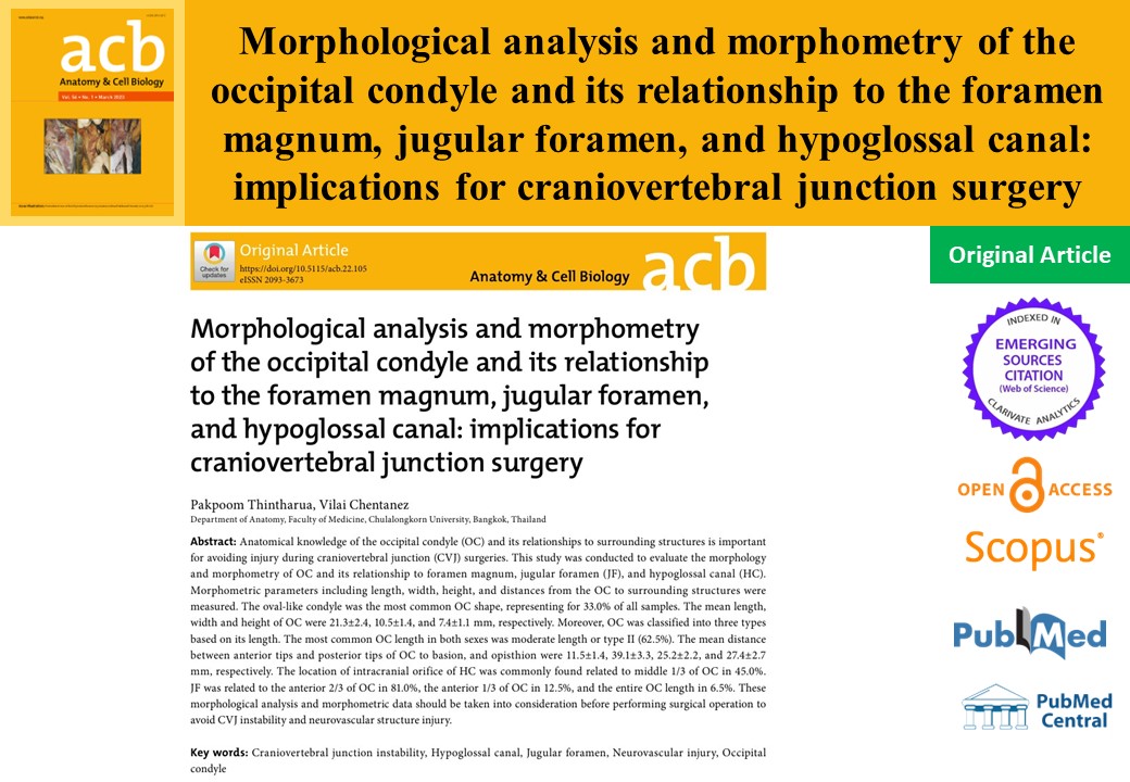 AcbjournalO's tweet photo. Morphological analysis and morphometry of the occipital condyle and its relationship to the foramen magnum, jugular foramen, and hypoglossal canal: implications for craniovertebral junction surgery

https://t.co/PwoCcWKSIG
Anat Cell Biol 2023; 56(1): 61-68

#AnatomyCellBiology https://t.co/LvZLIaV0NX