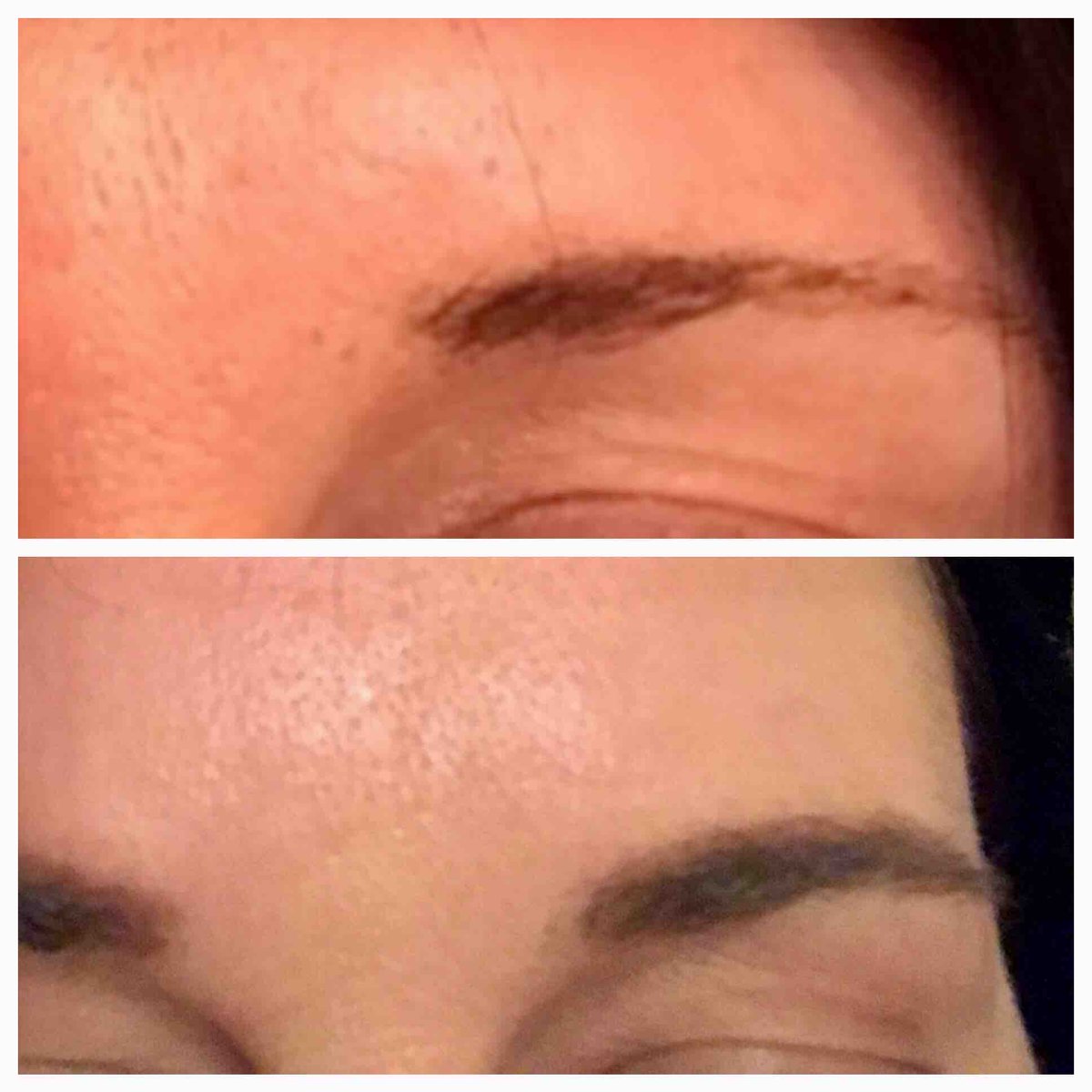 Did you know #Latisse can help your #eyebrows grow, too? Pic sent to us by a patient who bought it for her #eyelashes and decided to try it on her brows as well. 3 ml and 5 ml vials available. #drannetrussell #seibellamedspa #LittleRock #beauty #medspa #doctor 😘501-228-6237