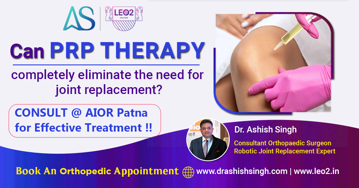 Can PRP Therapy completely eliminate the need for joint replacement?

#prpdoctor #plateletrichplasma #prp #kneeexpert #hipreplacement #plateletrichplasmatreatment #plateletrichplasmainjection #prpkneeinjection #prphipinjection  #anupinstitute #patnadoctor #drashishsingh