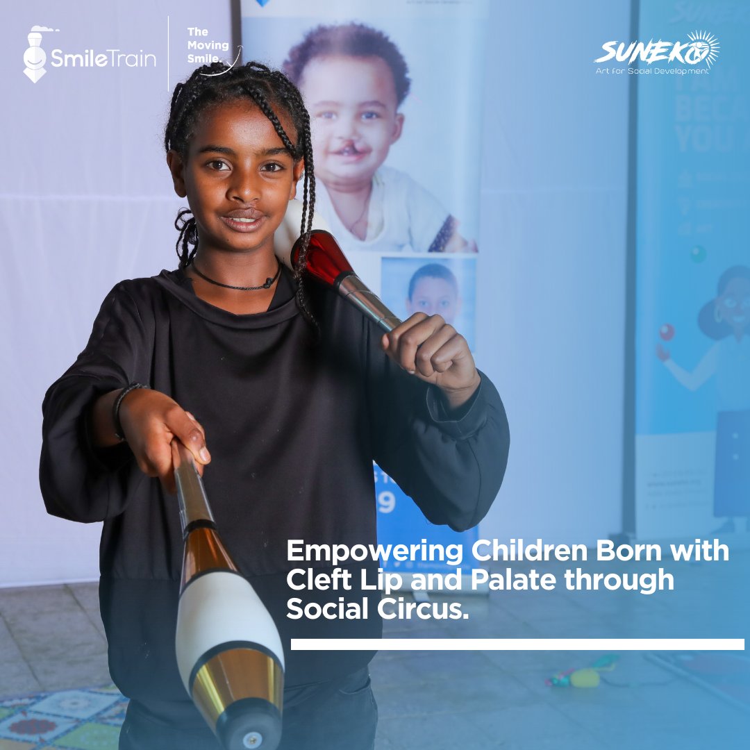 Empowering Children born with Cleft Lip and Palate through Social Circus. 

Boosting confidence, fostering belonging, celebrating individuality, and nurturing resilience. Join our transformative summer camp!

#SummerCamp2023 #EmpoweringLives #SmileTrain #smie