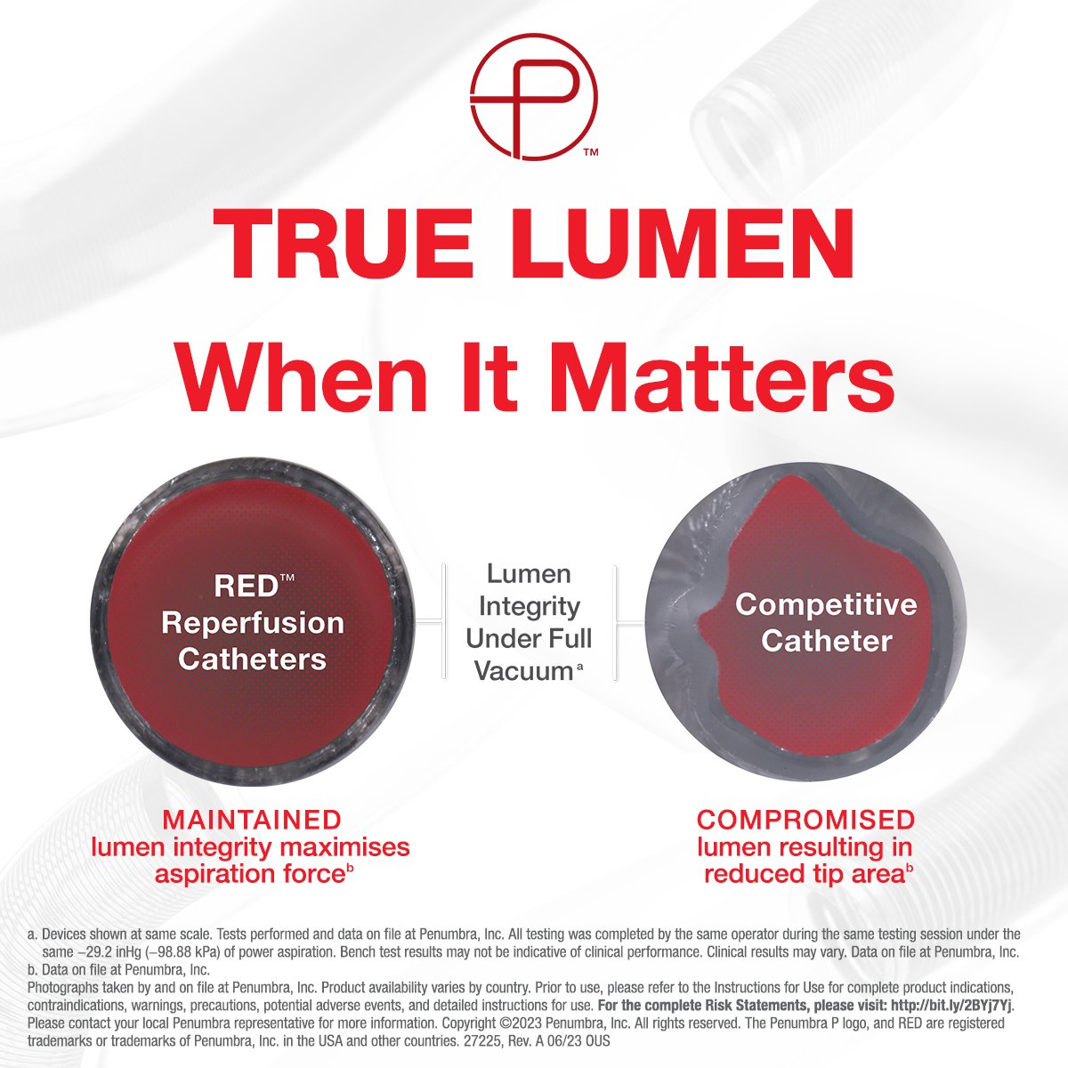 PenumbraEMEA's tweet image. EMEA HCPs: Penumbra’s RED Reperfusion Catheters designed to maintain their true lumen under powerful vacuum.

Discover the #REDglideDifference: bit.ly/3MAd3pl

#Stroke #NeuroVascular #PioneerInAspiration
Rx only. Risk info: bit.ly/2QHo8eH