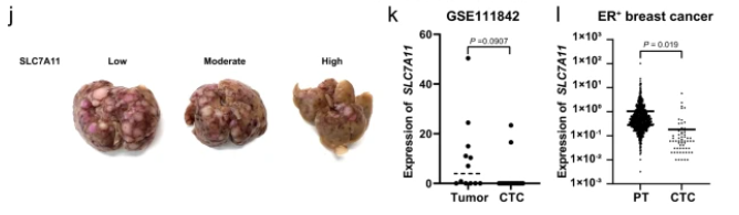 Nature Communications (@naturecomms) on Twitter photo The level of cystine transporter SLC7A11 leads to different outcomes in primary tumours and metastasis
nature.com/articles/s4146…
#CancerResearch <a href="/NatResCancer/">Cancer at Nature Portfolio</a>
<a href="/BoyiGan/">Boyi Gan, PhD</a> <a href="/MDAndersonNews/">MD Anderson Cancer Center</a> The level of cystine transporter SLC7A11 leads to different outcomes in primary tumours and metastasis
nature.com/articles/s4146…
#CancerResearch <a href="/NatResCancer/">Cancer at Nature Portfolio</a>
<a href="/BoyiGan/">Boyi Gan, PhD</a> <a href="/MDAndersonNews/">MD Anderson Cancer Center</a>
