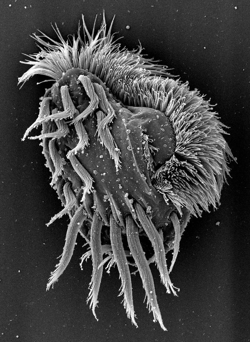 BEuplotes's tweet image. Punk rock Euplotes from the SEM with @samjlord.