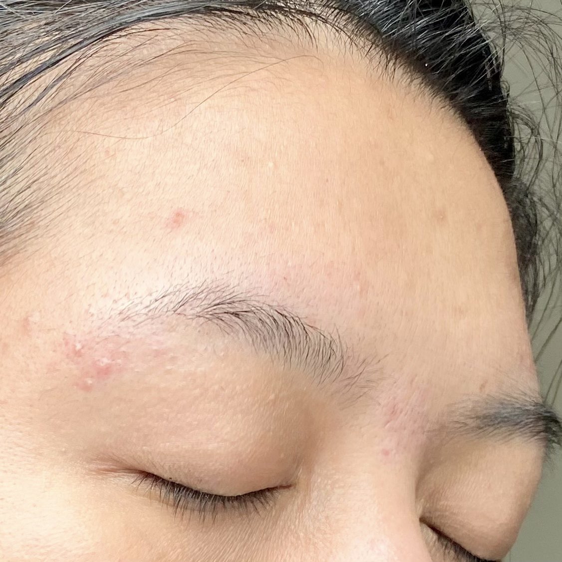 มา! ขอรีวิวตัวนี้หน่อย #EucerinProAcne 
Anti-Ance Mark เป็นเซรั่มลดสิว+รอยสิว ที่เกิดขึ้นซ้ำซาก ด้วย Salicylic Acid &amp; Thiamidol จากที่ใช้มารู้สึกว่ารอยสิวจางไวมากๆ สิวขึ้นใหม่ก็ลดน้อยลง ทั้งสิวอุดตันและอักเสบ💚 พิกัด bit.ly/3oQBnvf Watsons 1,080 ฿จ้า