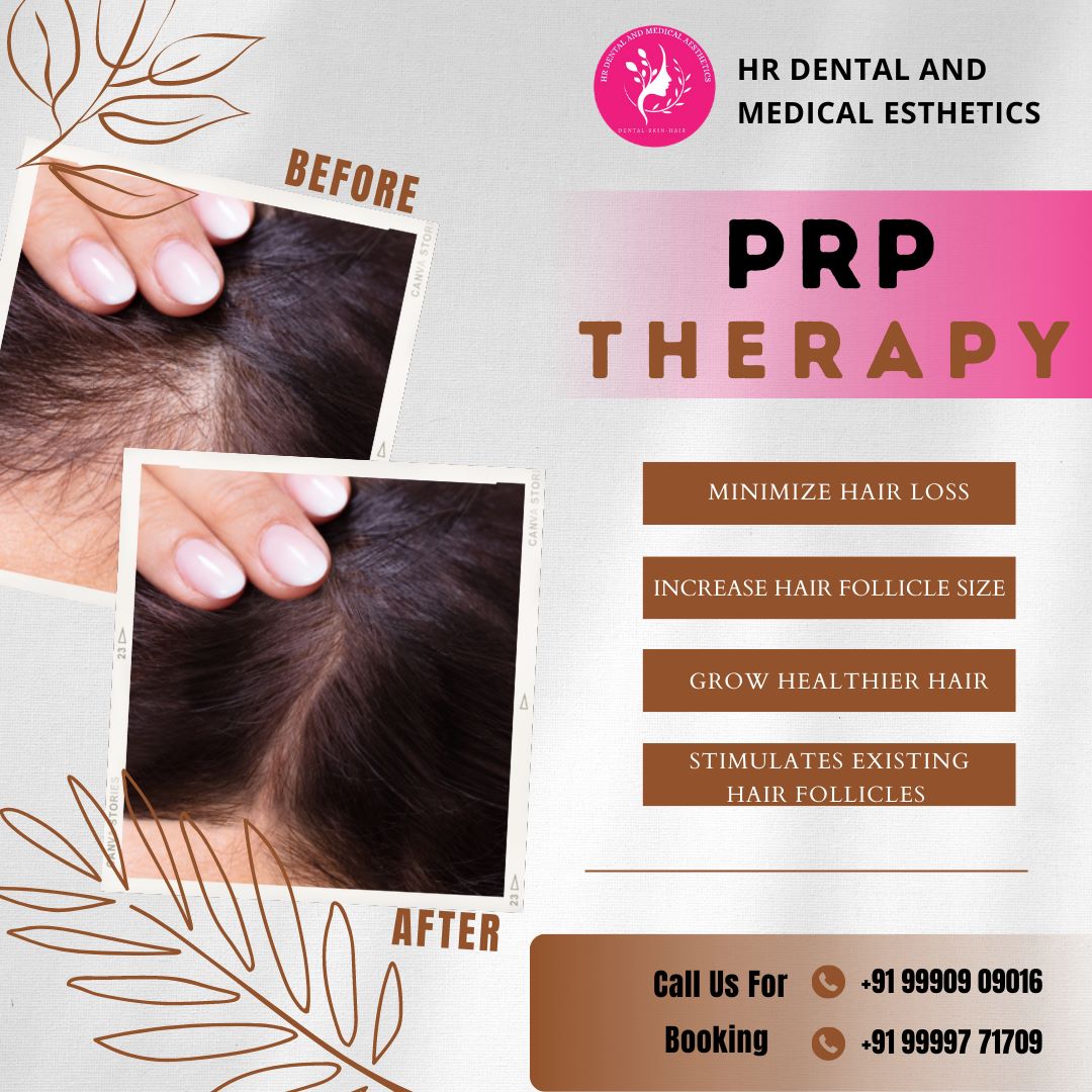 Experience the ultimate hair transformation at HR Dental And Medical Aesthetics.
For bookings, call Dr. Himani Bhardwaj at +91 99997 71709 & +91 99909 09016 or visit our clinic at SB 34, Shashtri Nagar, Ghaziabad.
#PRPHairTherapy #HairRestoration #PRPTreatment #hrdentalcare #Hair