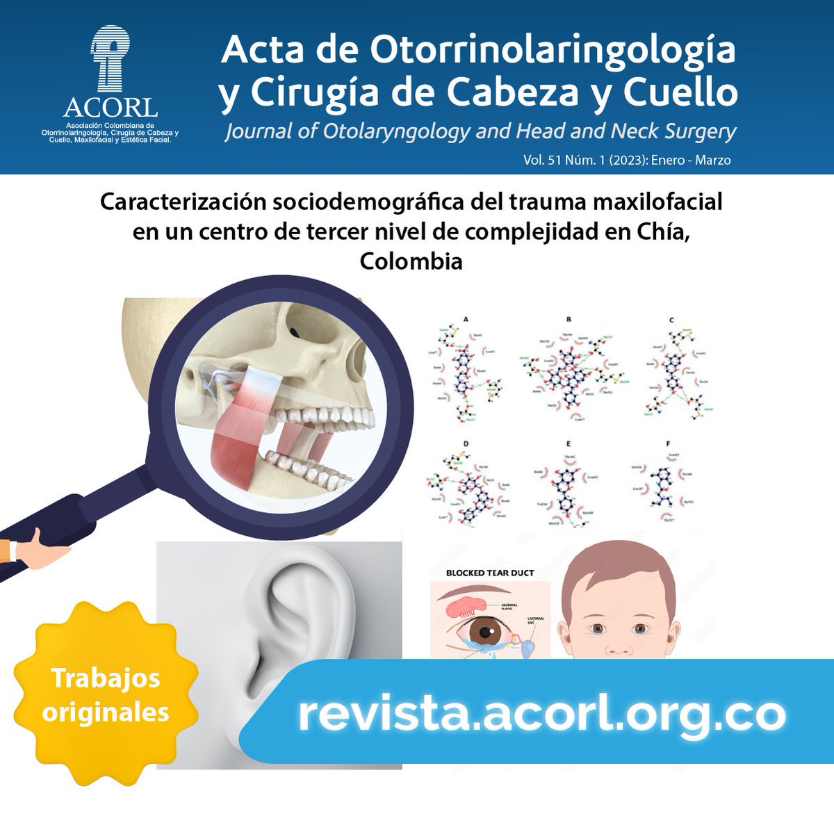 AcorlCo's tweet photo. Lo invitamos a conocer y leer algunos de nuestros artículos publicados en el último volumen de nuestra revista Acta de Otorrinolaringología &amp; Cirugía de cabeza y cuello.

1.  https://t.co/S7mDupr5Il
2. https://t.co/0i85uoSjT8
3. https://t.co/sFCKJXo5zJ
4. https://t.co/XOkL9PbHKN https://t.co/ZLOptRA4I3