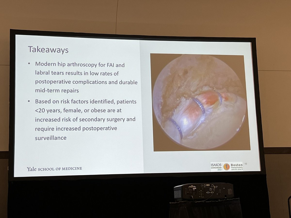 @ajaymalviya @ISAKOS Female sex, Age <20 & obesity. Risk factors for needing 2nd surgery after Hip Arthroscopy. Large database study (>30k) presented by @StephenGillinov

#isakos2023