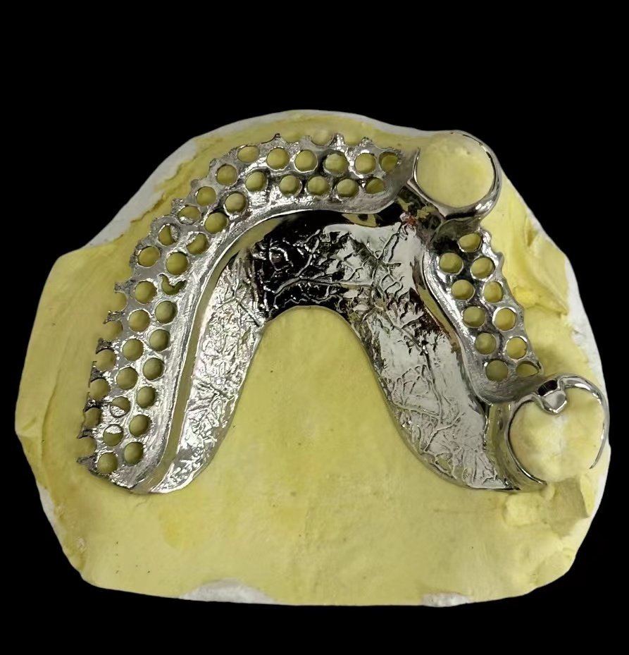 superdentsupply's tweet photo. After 2 days produce and 3 days DHL, our Malaysia partner get our partials and testing on the model, it is not only a Titanium partial but aslo a metal shining art. we will help our partners with better and better partials.
#Titaniumpartial #partialframework
#RPD #金属床 https://t.co/G7GBwn6PQq