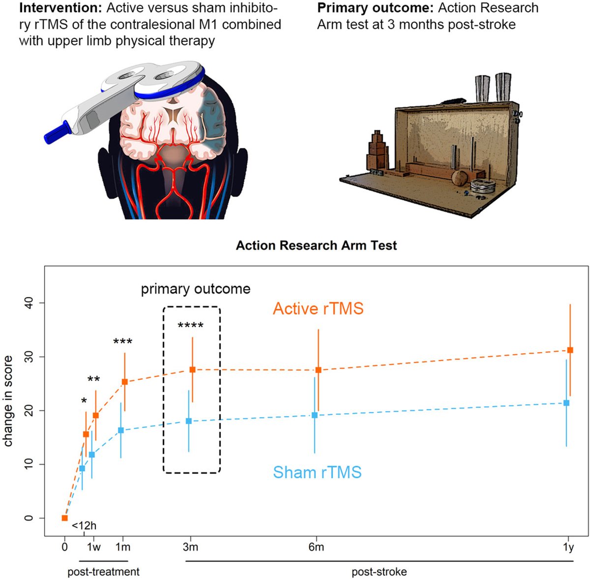 #STROKE Randomized #ClinicalTrial shows contralesional theta burst stimulation promotes upper limb motor recovery after stroke. #AHAJournals ahajrnls.org/3qRrNbX

#Editorial by Feng et al: Poststroke #TMS: what we have learned? ahajrnls.org/46alwIC