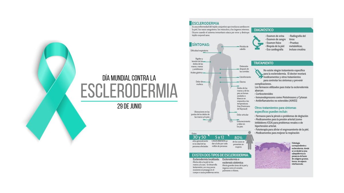 AEEED (@enferdigestiva) on Twitter photo ❓Sabías que el 82% de pacientes con #esclerodermia tienen manifestaciones digestivas?
👉esclerodermia.com/wp-content/upl…
<a href="/ESGENAnurses/">ESGENA</a> <a href="/GIjournal/">GI Journal Club</a> <a href="/ffpaciente/">Asociación FFPaciente</a> <a href="/AEEsclerodermia/">A. E. Esclerodermia</a> #endoscopynursing #enfemera ❓Sabías que el 82% de pacientes con #esclerodermia tienen manifestaciones digestivas?
👉esclerodermia.com/wp-content/upl…
<a href="/ESGENAnurses/">ESGENA</a> <a href="/GIjournal/">GI Journal Club</a> <a href="/ffpaciente/">Asociación FFPaciente</a> <a href="/AEEsclerodermia/">A. E. Esclerodermia</a> #endoscopynursing #enfemera