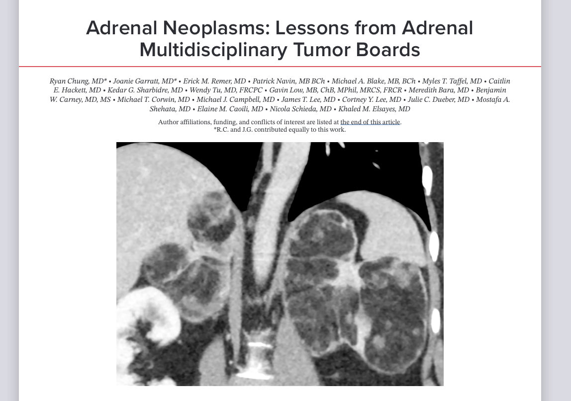 Erick Remer (@erickmremer) on Twitter photo New insights into adrenal imaging by <a href="/SocietyAbdRad/">Society of Abdominal Radiology | SAR</a> <a href="/adrenaldfp/">SAR_AdrenalDFP</a> out today! <a href="/RadioGraphics/">RadioGraphics</a> pubs.rsna.org/doi/epdf/10.11… New insights into adrenal imaging by <a href="/SocietyAbdRad/">Society of Abdominal Radiology | SAR</a> <a href="/adrenaldfp/">SAR_AdrenalDFP</a> out today! <a href="/RadioGraphics/">RadioGraphics</a> pubs.rsna.org/doi/epdf/10.11…