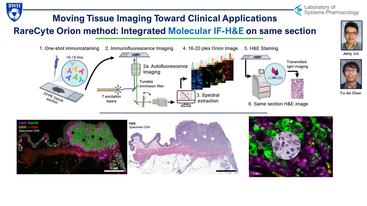 Out today! In @NatureCancer : Integrating multiplexed IF + HE (IF-HE) for high performance tissue biomarkers. Integrating molecular info &  #DigitalPathology will be key for diagnostics & research nature.com/articles/s4301… Congrats @JiaRenLin, Yu-An Chen, Danny Campton, @RareCyte!