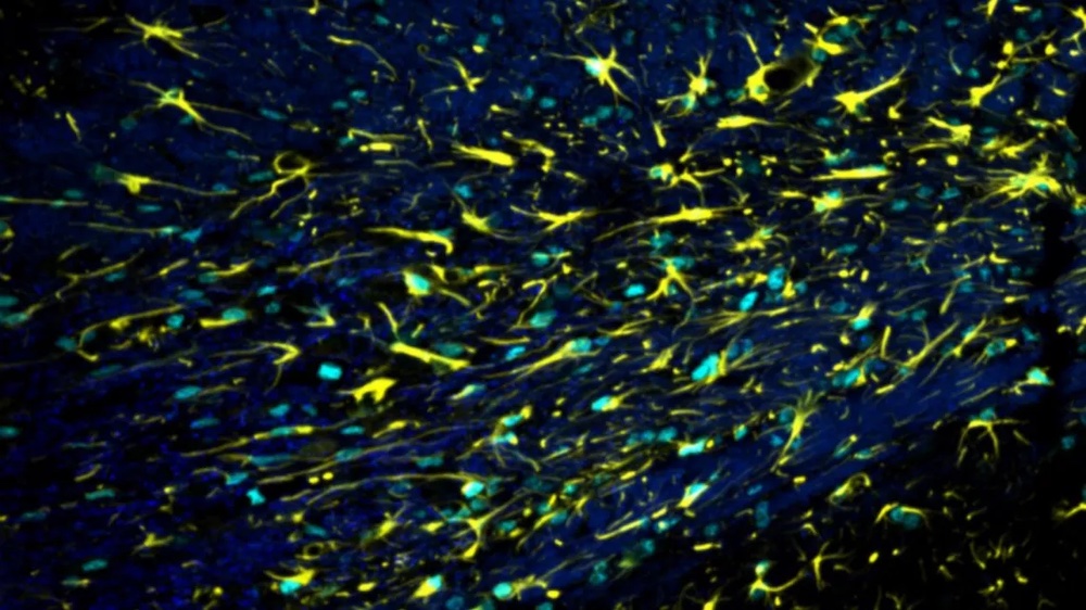 UK Dementia Research Institute (@ukdri) on Twitter photo 🚨New study from @MironLab (UK DRI at Edinburgh) reveals an important role for the star-shaped brain cells astrocytes in repairing myelin, the protective coating around neurons.
This could have important consequences in MS, Alzheimer's & other conditions👉buff.ly/44fP2uI 🚨New study from @MironLab (UK DRI at Edinburgh) reveals an important role for the star-shaped brain cells astrocytes in repairing myelin, the protective coating around neurons.
This could have important consequences in MS, Alzheimer's & other conditions👉buff.ly/44fP2uI