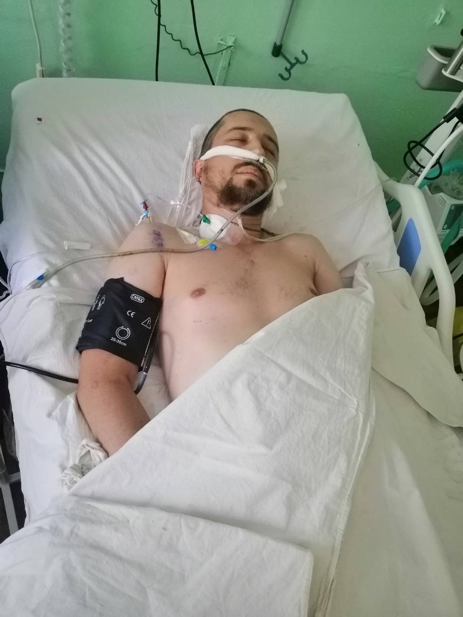 sternenko's tweet photo. Це Андрій Рибалко, морський піхотинець з однієї з бригад, якою ми опікуємось та багато допомагаємо. 

Під час виконання бойового завдання Андрій отримав тяжкі поранення, втратив обидві ноги. 

Прошу вас підтримати його та допомогти коштами на лікування та реабілітацію. 

Монобанка https://t.co/jFdO1QQtDr

Картка банки
5375 4112 0688 3576