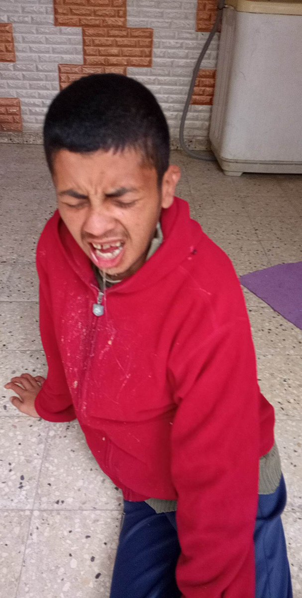 hfg_vcj's tweet photo. https://t.co/n53beaMRfk…🙏
I wish you would look at my child, my child is crying because of the severity of the many diseases that my child suffers from. Please donate in order to obtain treatment. Thank you.😞😓 https://t.co/2IQfkYKyHr