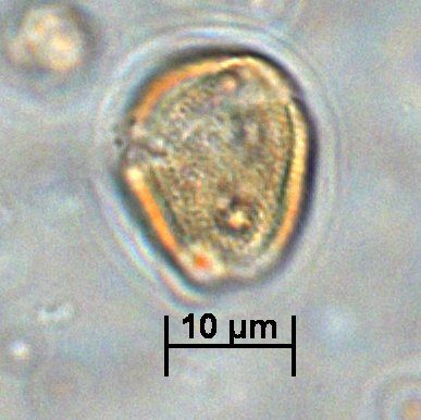 @eudepo1 @elignaciojara @thatpollenguy @FossilPollen @PalyJen @J_StevensonANU Oh thank you so much!! I hope it's not too much effort. This angled, blurry pic is all I've got at the moment, but I will attempt to get a good one when next at the microscope!