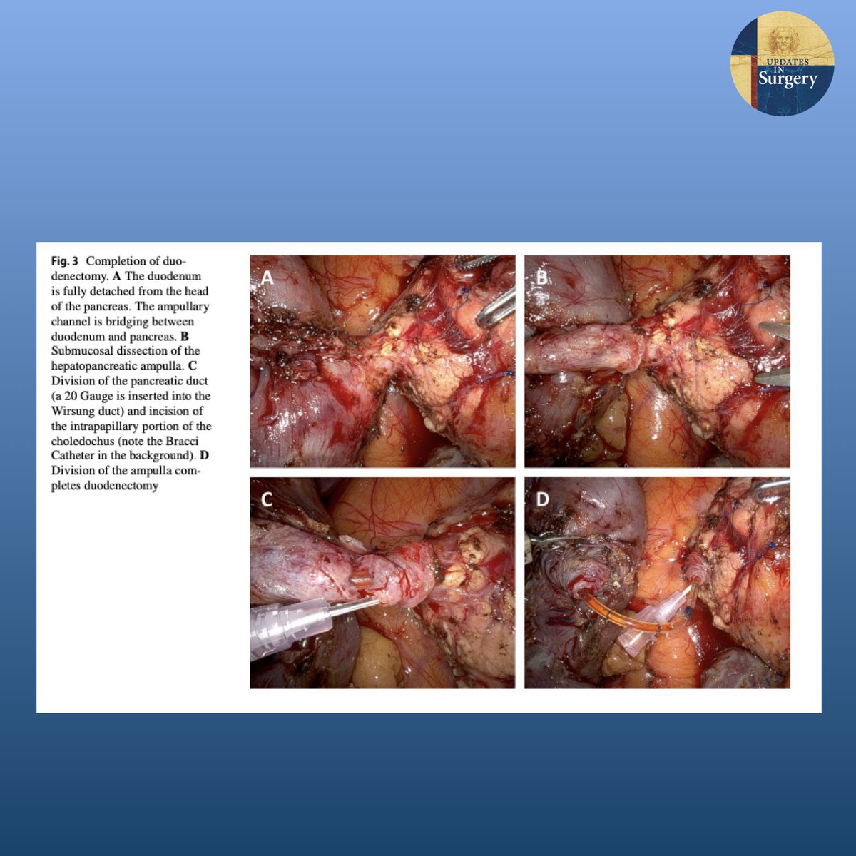 Updates in Surgery tweet media