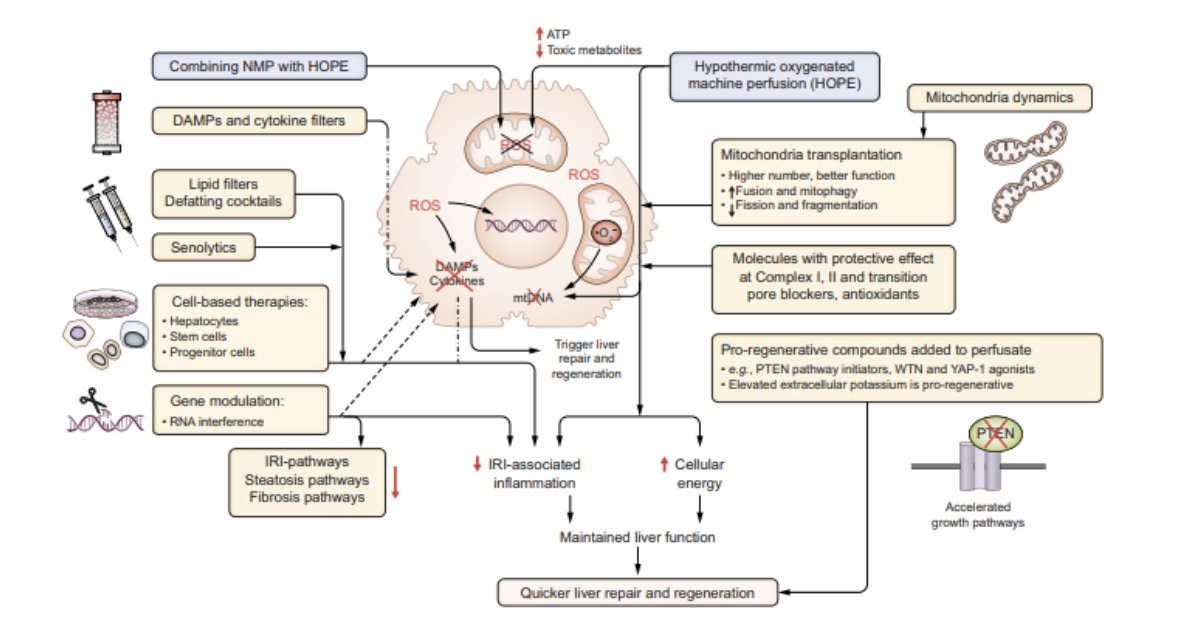BridgetoLifeLTD's tweet photo. #HOPEfortheWeek:
Machine perfusion of the liver and bioengineering
The combination of NMP with previous HOPE was shown beneficial and the addition of Damps/Cytokine filters into perfusion circuits is currently explored. While most additives that reduce IRI do also promote repair and regeneration pathways, a few specific molecules are currently tested during prolonged NMP.
https://t.co/hav3PERtDU
#HOPEForTheWeek #MachinePerfusion #HypothermicOxygenatedPerfusion #DCD #NRP #SCS #LiverPerfusion #LiverTwitter #Bioengineering
