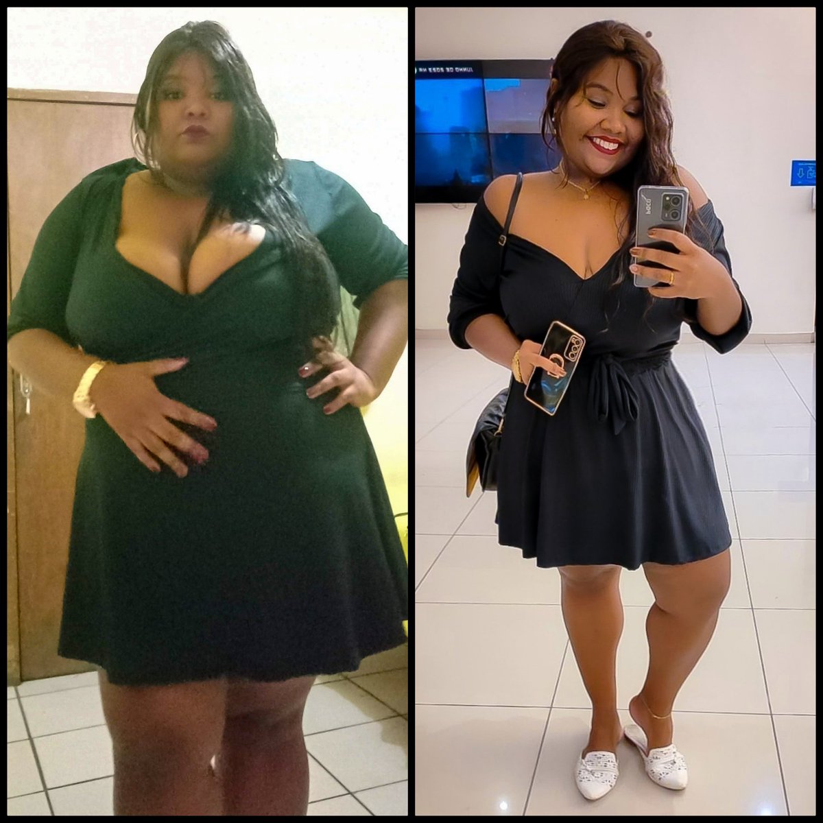 TacianaFroz's tweet photo. Completamente despeitada! Hahaha Tô sem airbags, mas tô com saúde! 😅
30kg eliminados com reeducação alimentar e atividade física. Eu conheci uma nova vida e não desejo voltar nunca mais pra antiga.
Deus é tão bom!
.
#fitness #treino #musculação #reeducacaoalimentar #obesidad https://t.co/f9WfnTnrlG