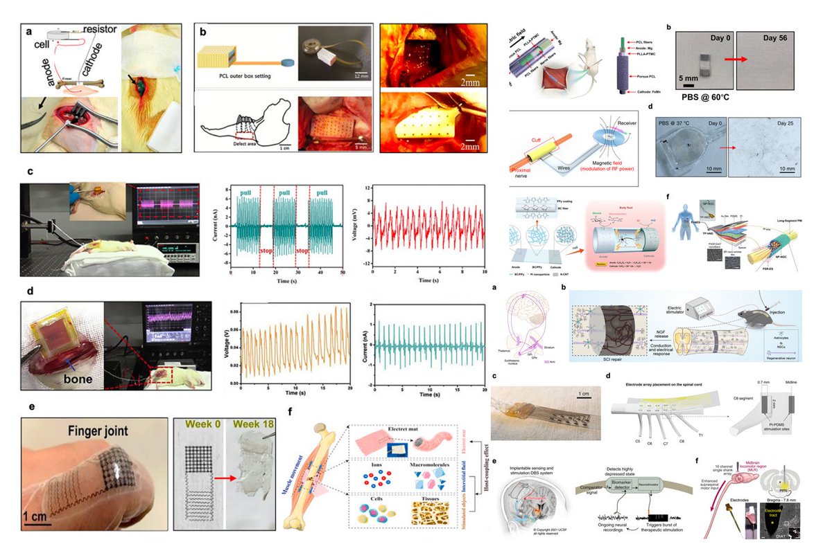 Novel implantable devices delivering electrical cues for tissue regeneration and functional restoration
sciencedirect.com/science/articl…
#MedTwitter #scicomm #MedEd #AcademicTwitter 
#SCI #PCL