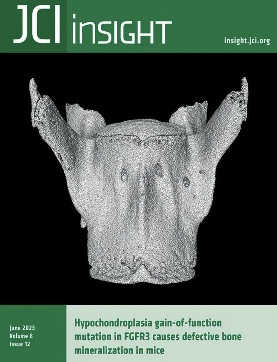 lea-loisay (@lealoisay) on Twitter photo I am pleased to announce my thesis publication in <a href="/JCI_insight/">JCI insight</a> on Hypochondroplasia gain-of-function mutation in FGFR3 causes defective bone mineralisation in mice buff.ly/3XzexFv . Thanks to my amazing mentors and colleagues <a href="/LLM_Lab/">Laurence Legeai-Mallet_Lab</a> I am pleased to announce my thesis publication in <a href="/JCI_insight/">JCI insight</a> on Hypochondroplasia gain-of-function mutation in FGFR3 causes defective bone mineralisation in mice buff.ly/3XzexFv . Thanks to my amazing mentors and colleagues <a href="/LLM_Lab/">Laurence Legeai-Mallet_Lab</a>