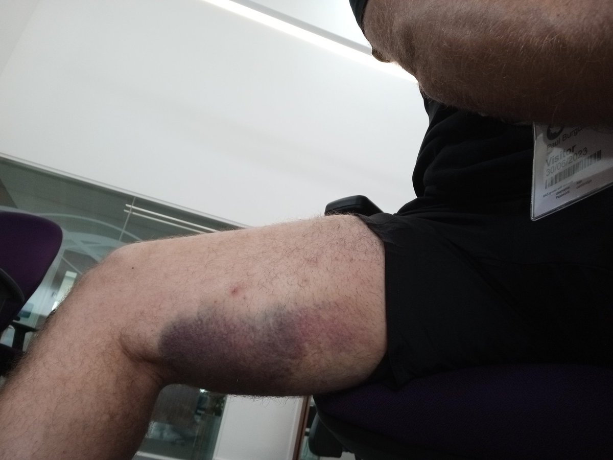 Paul Burgum tweet media