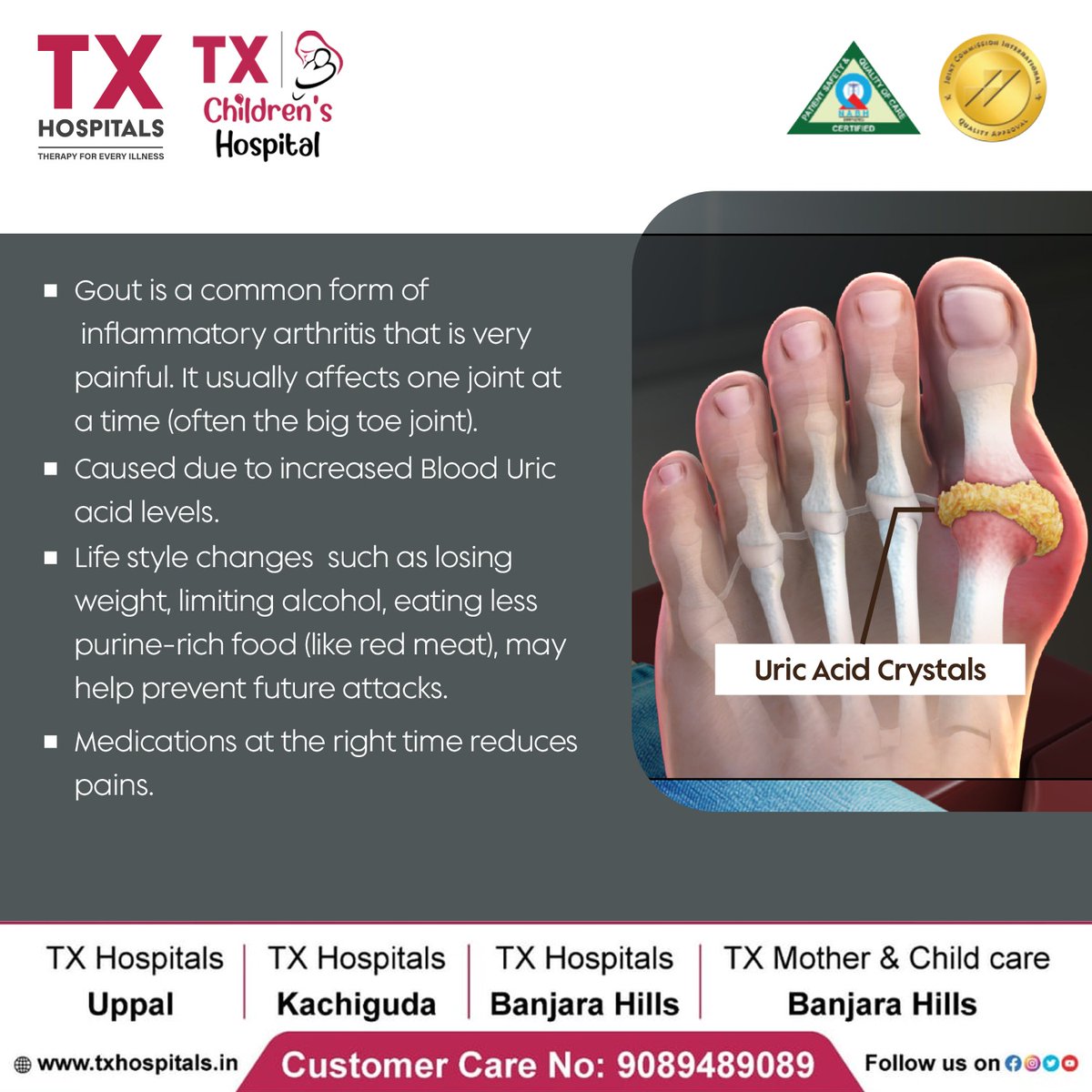 📷 Say Goodbye to Gout Pain! Discover Effective Ways to Prevent and Manage It!
Visit us:
📷txhospitals.in
CRM NO: 9089489089
#TXHospitals #GoutAwareness #ArthritisPainRelief #InflammatoryArthritis #PainfulJoints #GoutPrevention #HealthyLifestyle #WeightLossJourney