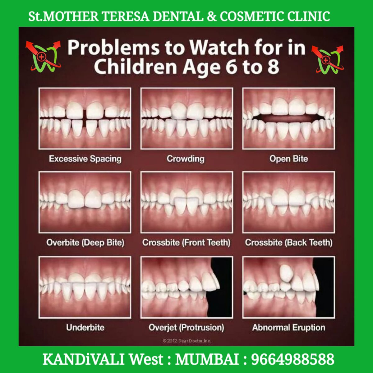 mother_dental's tweet image. Some Problems in Children that should be addressed at the age of 6 to 10 years
Please call or watsapp us for Preventive check of your kids on 096649 88588 
Branches :-
1. KANDiVALI West : MG Road
2. KANDiVALI West : Ganesh Nagar
3. POISAR EAST : Gown Devi Road #openbite
