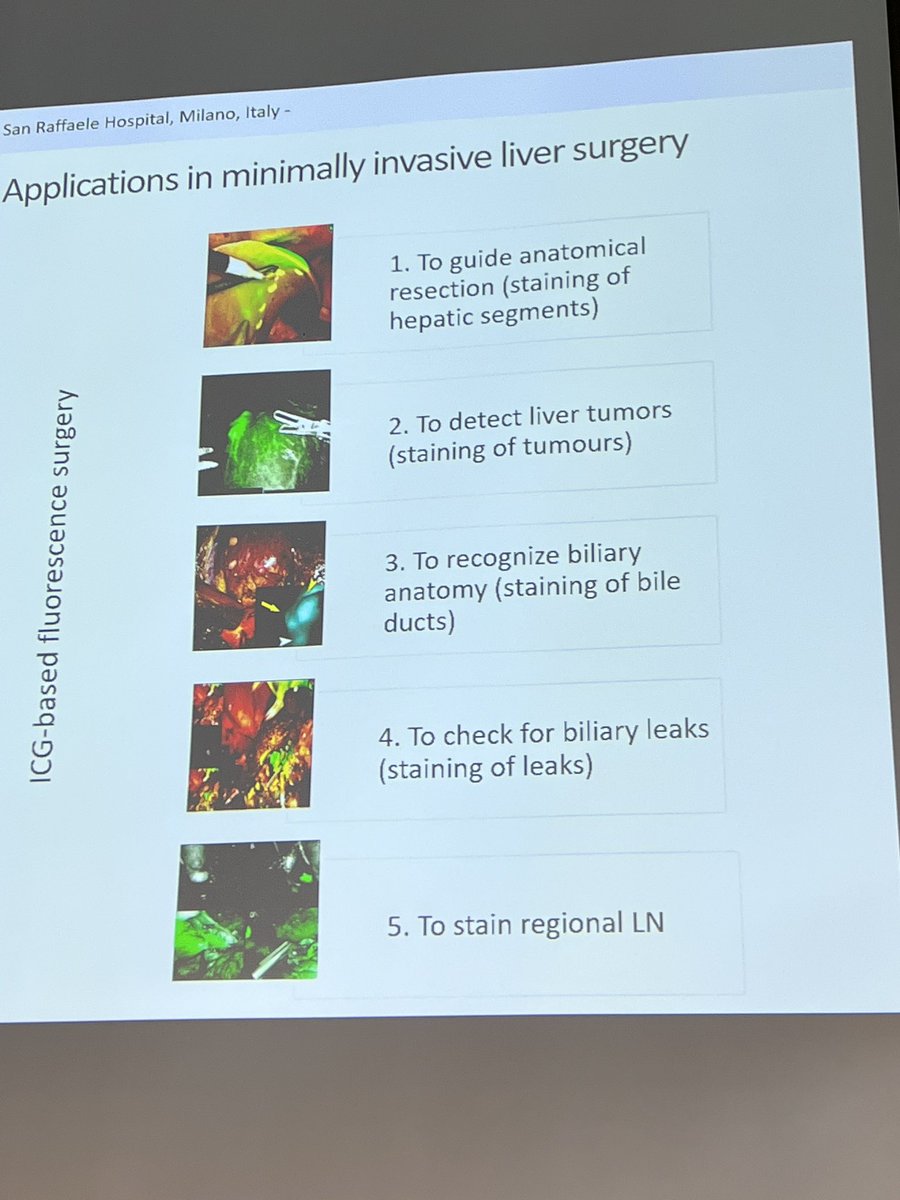 @FrancescaRatti3 on the marvels of #icg in #lapliversurgery. Start of day 2 @Team_Winterberg @DrGreg84438194 @JovineElio @ESchadde @ILLS_LAPLIVER @EAHPBA @LiverSurgSanRaf