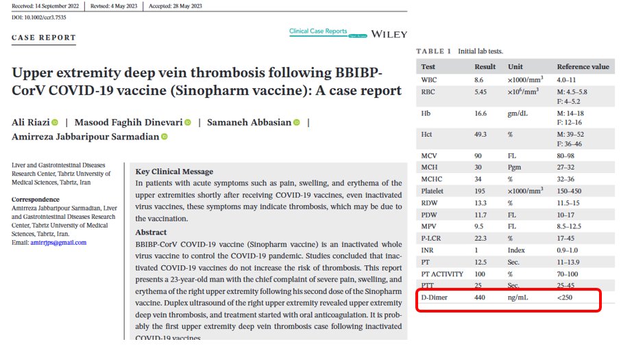 '... in patients with acute symptoms such as pain, swelling & erythema of the upper extremity shortly following COVID-19 vaccines ... these symptoms may indicate thrombosis which may be due to the vaccination.'
-> onlinelibrary.wiley.com/doi/10.1002/cc…